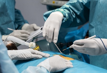 pharma_outlook's tweet photo. Agilis Robotics Introduces Significant Advancements in Endoluminal Surgery
News: https://t.co/S7O28uZzhp
Agilis Robotics Limited
Agilis Mechanical technology
#AgilisRobotics #pharmabiz #clinicalphasetherapy #cystoscopes https://t.co/CDEyw3jNhl