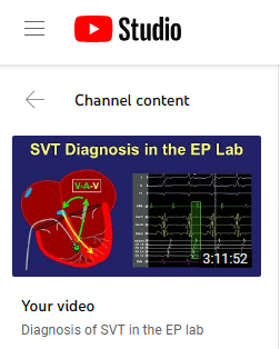 Wow. Not even 6 days after release of the SVT video, we're over 4,700 views and almost 1000 hours of watch time (!!) 🤯 It seems this may help address an unmet educational need, and it's wonderful to see! 🥹