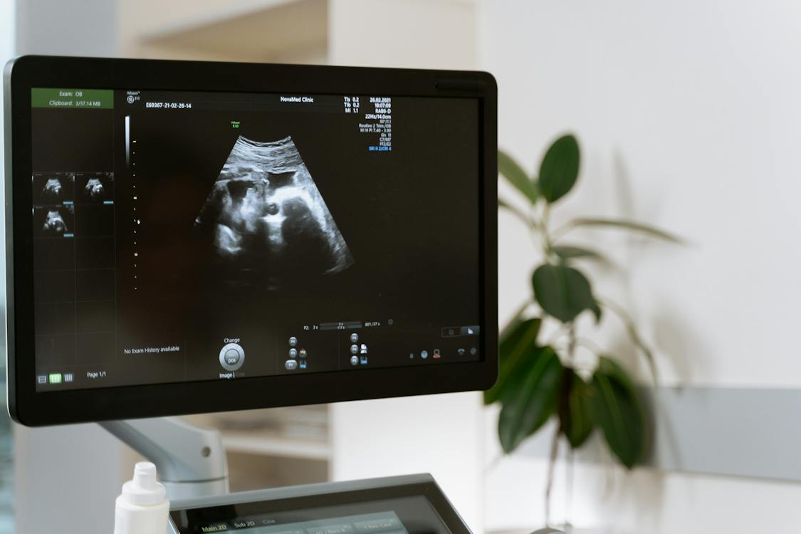 Doppler Ultrasound Global Market Report 2024

Read more @ thebusinessresearchcompany.com/report/doppler…

#UltrasoundTechnology #healthcare #healthcaredevices #ultrasoundscan #HealthTechInnovation