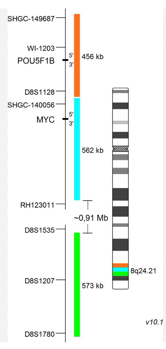Marta Salido, PhD (@marta_msalido) on Twitter photo MYC variant reareangement t(2;8)(p11;q24) detected by karyotyping and confirmed by tricolor FISH break-apart probe (breakpoint at PVT1). FISH detected a small nuclei population of 5% with MYC rearrangement alone suggesting that agressive lymphoma evolves from a small lymphocyte. MYC variant reareangement t(2;8)(p11;q24) detected by karyotyping and confirmed by tricolor FISH break-apart probe (breakpoint at PVT1). FISH detected a small nuclei population of 5% with MYC rearrangement alone suggesting that agressive lymphoma evolves from a small lymphocyte.