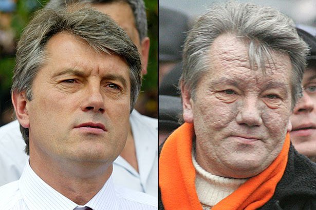 creepydotorg's tweet photo. Victor Yushchenko before and after being poisoned during his presidential campaign in Ukraine 2004. https://t.co/Im0ubqBbIJ