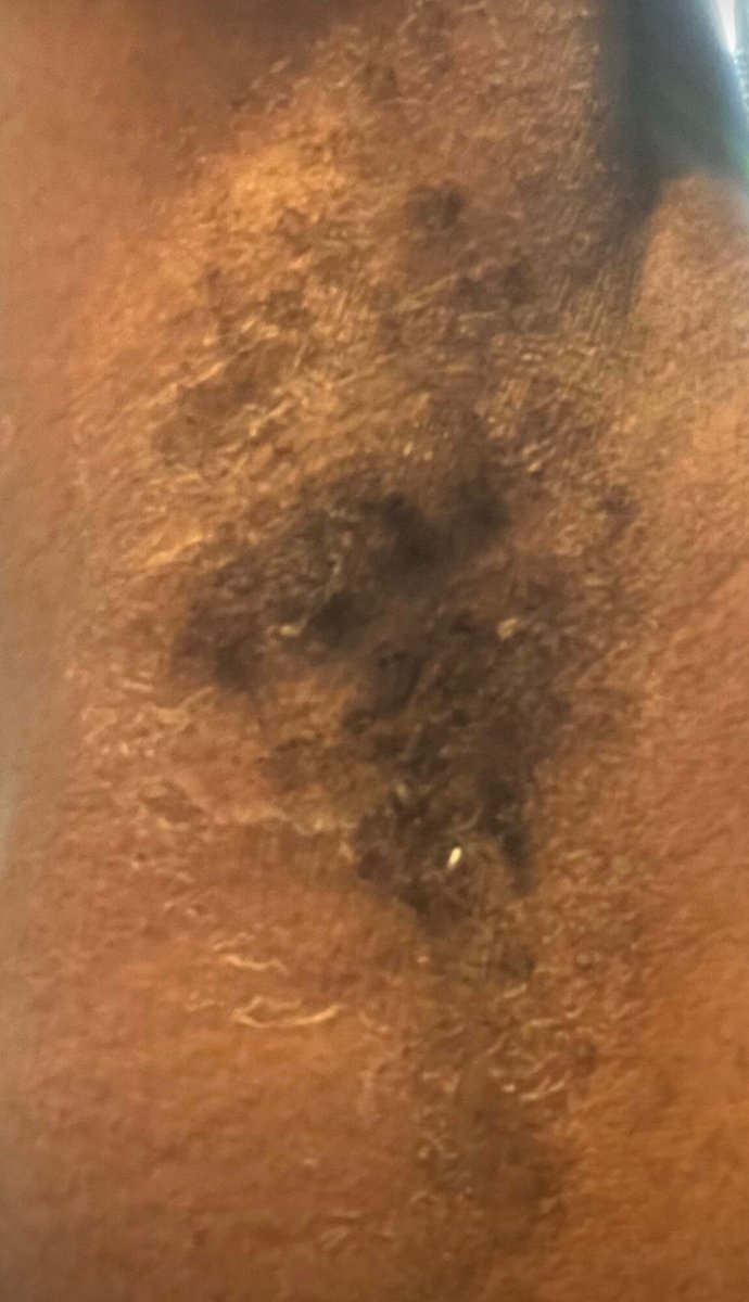 abs902102002's tweet photo. @FlorisLondon So If your Customers have a reaction to your products, your give  cold hearted responses?

It’s not about the money, you can keep it, I’m more concerned about my skin that’s been peeling for upto a week now. 

Cefiro deodorant https://t.co/bDMm4nBRlM