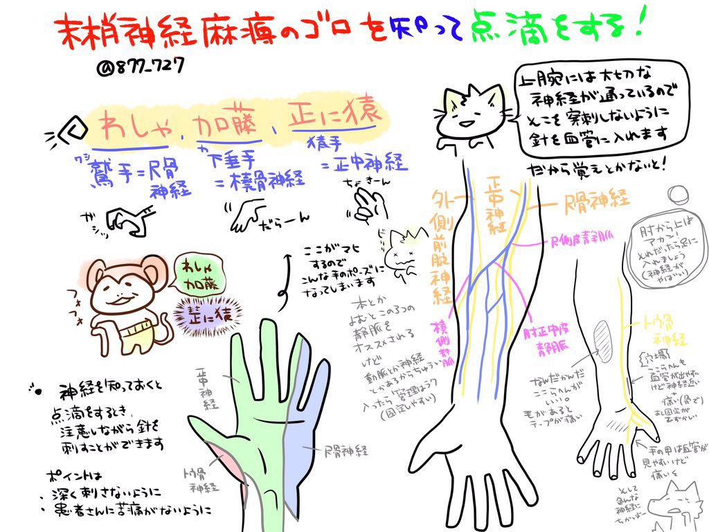 【末梢神経麻痺の語呂合わせとVライン留置:技術】
これはかなり役立つ知識なのですが下垂手といえばの橈骨神経麻痺はSaturday night palsyといいます。恋人を腕枕したときには手の甲らへんが痺れることからきているぞ✌️
点滴静脈注射のときは神経に気をつけて穿刺しよう🐱