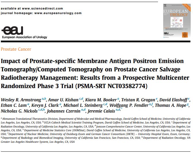 In the #PSMA #PETimaging arm of the randomized PSMA-SRT trial <a href="/UCLA/">UCLA</a> and <a href="/UCSF/">UC San Francisco</a>, M1 disease was detected in ~10% and there was 18% more treatment escalation than in the control arm. Will this lead to improved PSA outcomes? Analysis is planned for 2025.
sciencedirect.com/science/articl…