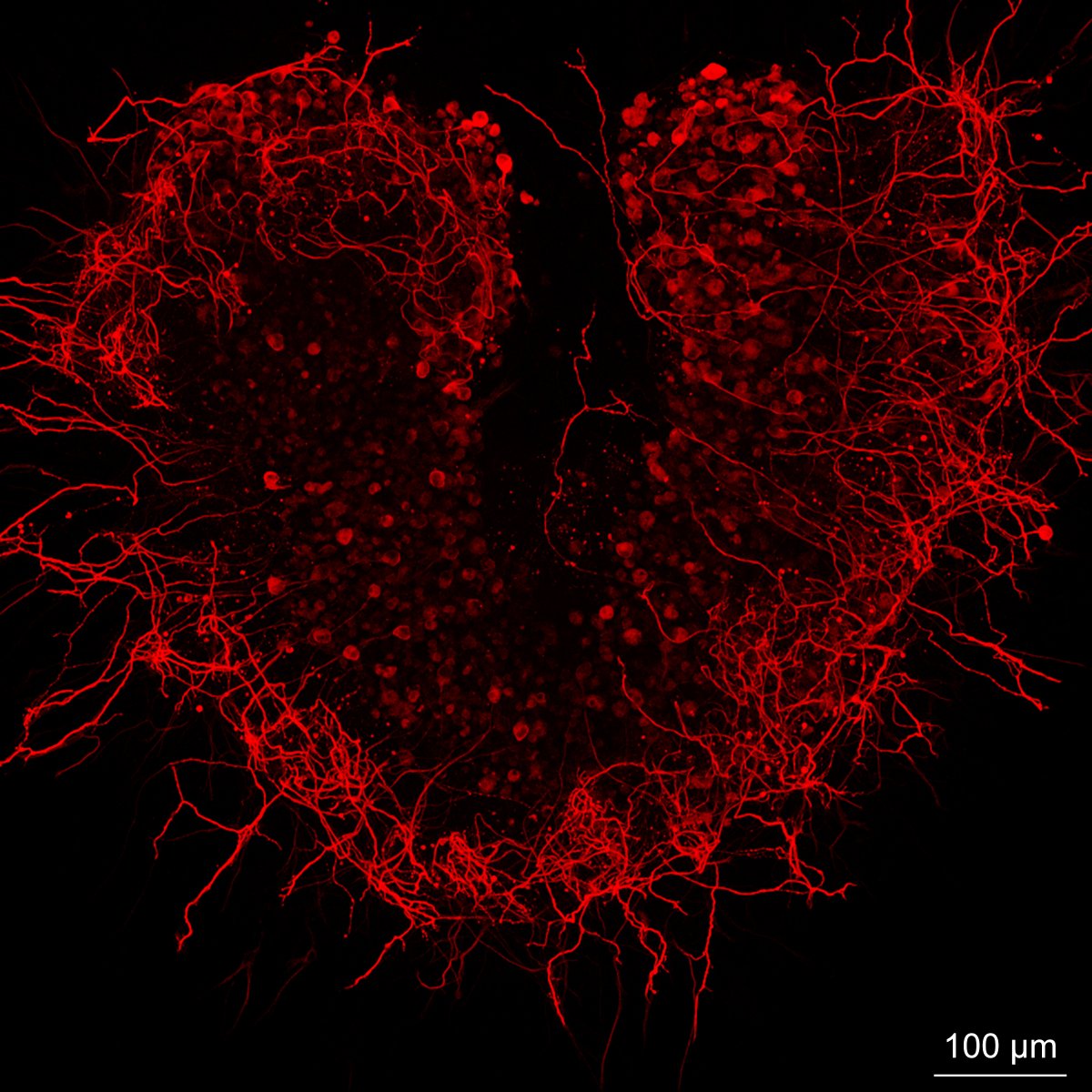 #SciArt for Valentine's Day: Auditory nerve cells, the cells that transmit sound information from the inner ear to the brain, grown in a culture dish. Tag a friend who would love this! 📷 Dr. Alain Dabdoub, @Sunnybrook & Dr. Mirko Scheibinger, @StanfordMed