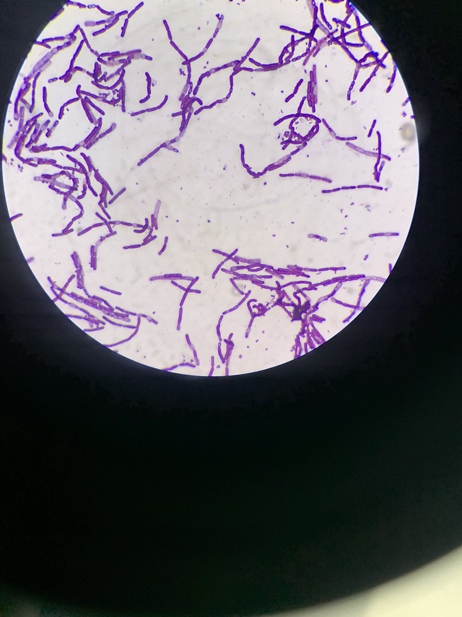 Pre_cious_ness's tweet photo. @jcomls Had something like this from gram (same urine sample) and it was bacillus spp. https://t.co/RaXlEBUXpG