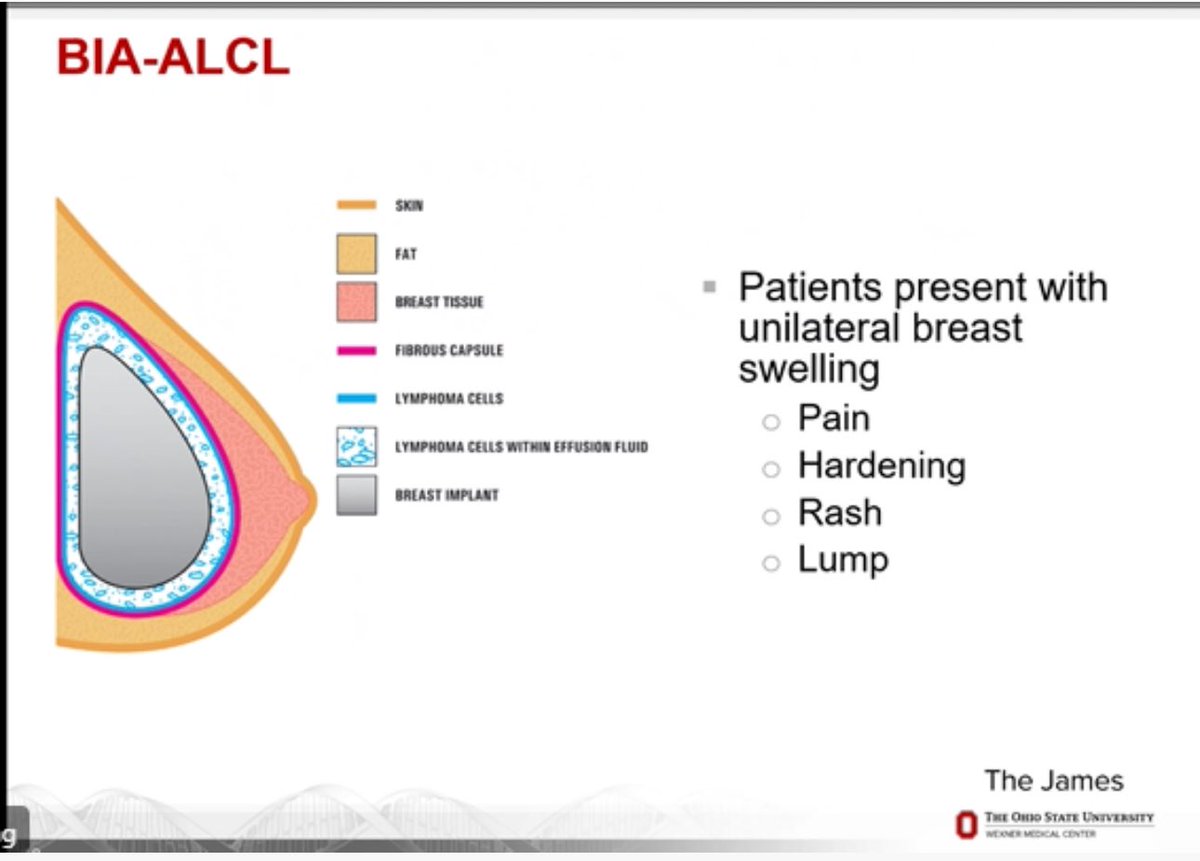 Breast Imaging Fellowship Consortium (@breastradfellow) on Twitter photo Thank you to Dr Min-Jeong Cho from <a href="/OhioStateSurg/">Ohio State Wexner Medical Center Surgery Dept.</a> , Plastic Surgery Division for lecturing our fellows on breast reconstruction options. Advances in microvascular surgery are exciting giving our patients many options! Great to know how rads can help with surgical planning. Thank you to Dr Min-Jeong Cho from <a href="/OhioStateSurg/">Ohio State Wexner Medical Center Surgery Dept.</a> , Plastic Surgery Division for lecturing our fellows on breast reconstruction options. Advances in microvascular surgery are exciting giving our patients many options! Great to know how rads can help with surgical planning.