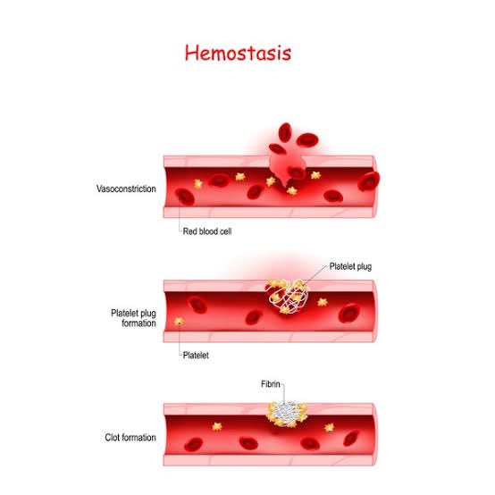 DrMedica_13's tweet photo. 🩸 Time for a clotting quiz!
Which clotting factor converts #fibrinogen_to_fibrin?
A. Factor V
B. Factor VIII
C. Factor X
D. Factor XIII
#MedicalQuiz #ClottingFactors #CoagulationCascade 🩹💉 https://t.co/nPhQ25ilIh