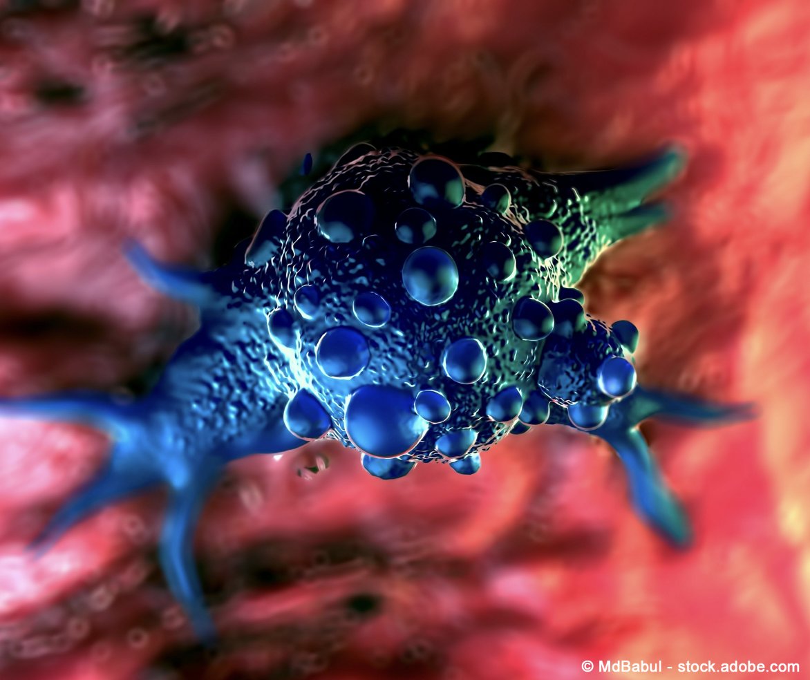 OncLive.com (@onclive) on Twitter photo First-line pembrolizumab plus cabozantinib was efficacious and had a manageable toxicity profile in patients with advanced urothelial carcinoma, including those who were ineligible for cisplatin. <a href="/rohitjainMD/">Rohit Jain, MD</a> <a href="/MoffittNews/">Moffitt Cancer Center</a> <a href="/ASCO/">ASCO</a> #GU24 #blcsm onclive.com/view/frontline… First-line pembrolizumab plus cabozantinib was efficacious and had a manageable toxicity profile in patients with advanced urothelial carcinoma, including those who were ineligible for cisplatin. <a href="/rohitjainMD/">Rohit Jain, MD</a> <a href="/MoffittNews/">Moffitt Cancer Center</a> <a href="/ASCO/">ASCO</a> #GU24 #blcsm onclive.com/view/frontline…