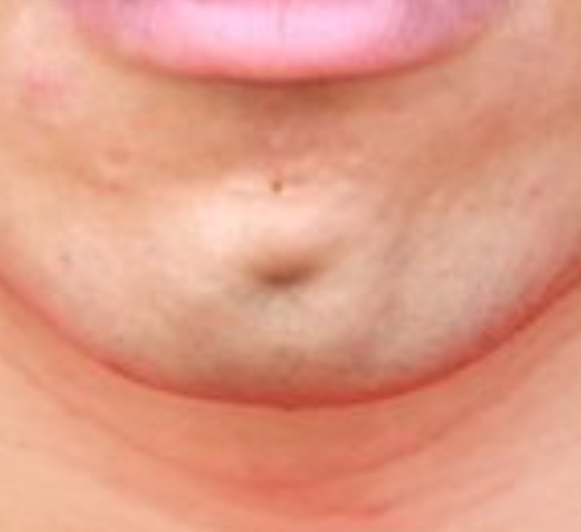 HevenzG's tweet photo. @JoeyMannarinoUS Joey Mannarino's Chin is a piece of shit.

Joey Mannarino's Wife is a piece of shit. https://t.co/A1CVjmPYA3
