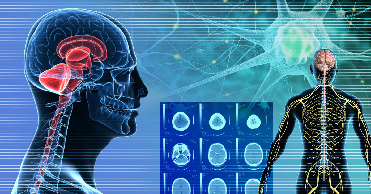 Serum L1EV α-synuclein levels were highly correlated with specific combinations of known markers of prodromal Parkinson disease in a large cross-sectional study. jwat.ch/3OAx4hg

#NeuroTwitter <a href="/WagleShukla/">Aparna Wagle Shukla</a> #Parkinsons