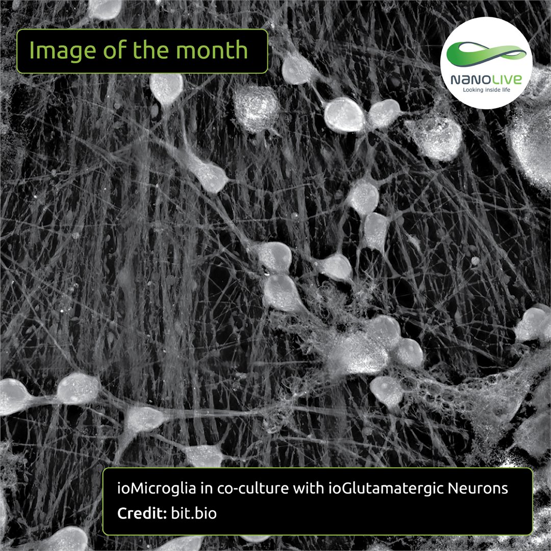 NanoLiveLtd's tweet image. “Image of the Month”: Microglia cells patrol a neural network in vitro. Imaged during 3.5-hour using our 3D Cell Explorer 96focus. Thank you to @bitbio for sharing this beautiful image with us! 💫 bit.ly/4buVPW4
#ImageOfTheMonth #CellImaging #Nanolive