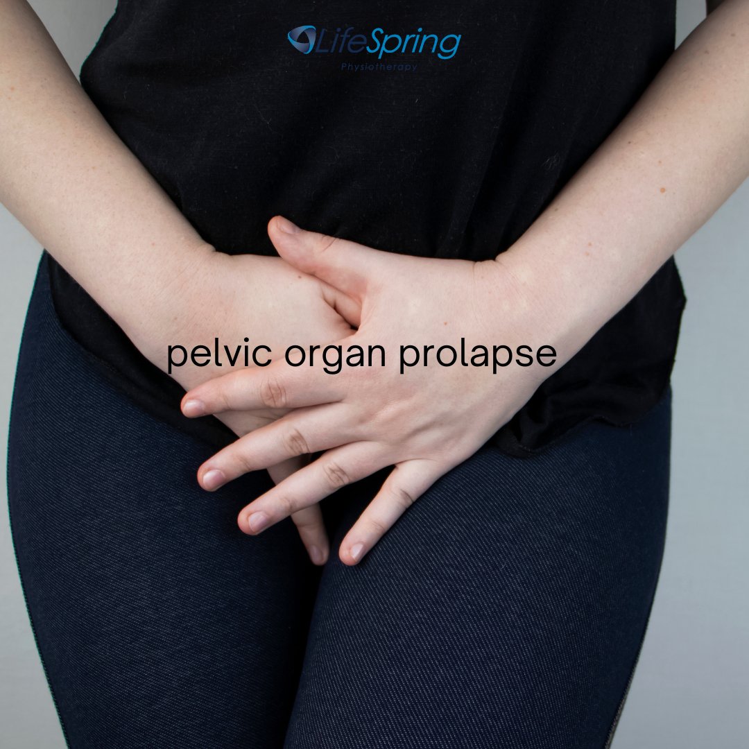 Pelvic Floor physiotherapy is considered the first line treatment for all stages of pelvic organ prolapse. Call to book your free 10 min phone consultation with Amber to learn how pelvic floor physio can treat your pelvic organ prolapse. #physiocanhelp #pelvicfloor #womenshealth