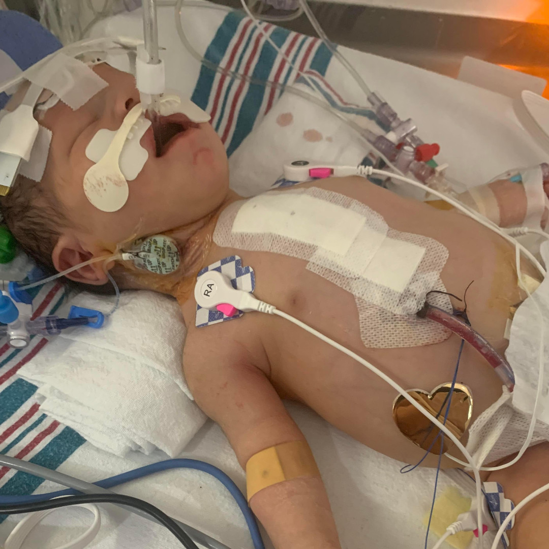 UnivHealthSA's tweet photo. Baby Naabaahii is already paying homage to his name, which means "warrior" in Navajo. After an emergency #openheart surgery to correct total anomalous pulmonary venous return, #TAPVR, he is now thriving!
Learn more about our Pedi Congenital Heart Center: https://t.co/A7OVNDmbBr https://t.co/gcKUEAIOph