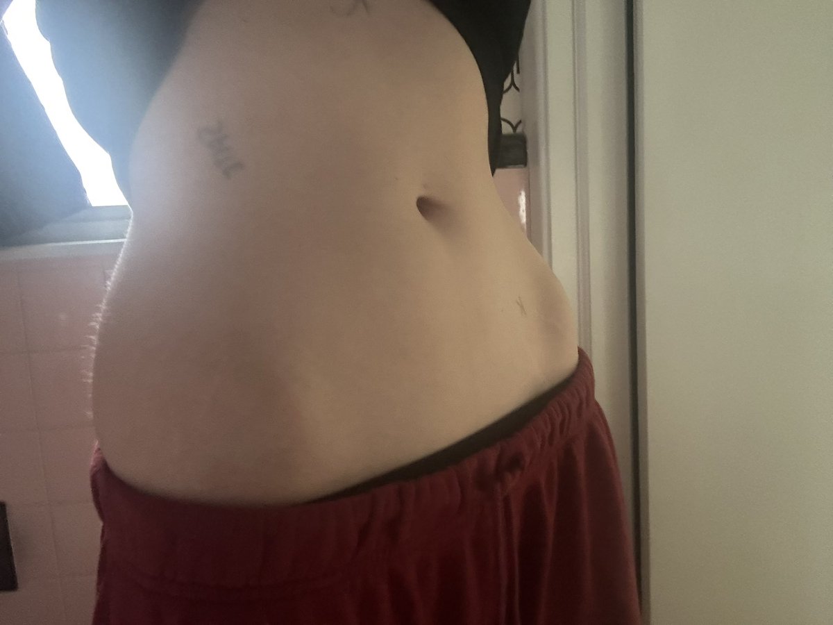 ST0N3REXIC's tweet photo. if hip bones stick out why still fat https://t.co/PBnlU6FzcL