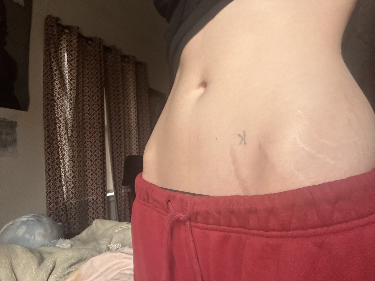 ST0N3REXIC's tweet photo. if hip bones stick out why still fat https://t.co/PBnlU6FzcL