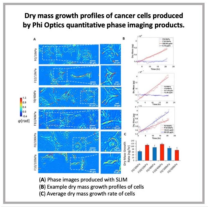 phioptics's tweet image. Quantitative phase imaging and engineered extracellular matrices uncover differences in cancer behavior showing growth and migration aspects of oncogenesis. #QuantitativePhaseImaging #CancerCellBehavior #Oncogenesis #CellBiology #CancerResearch
Read... ow.ly/c7Gt50QwKqy