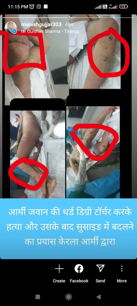 DeepakK79200593's tweet photo. @PMOIndia
@CMOKerala
@ZeeNews
@aajtak
ग्रेटर नोएडा के गाँव खेडी से ऑर्मी जवान के साथ केरल में ड्यूटी के दौरान सीनियर ऑफिसर के द्वारा बर्बरता से मारपीट करके फाँसी पर लटका दिया ओर पुलिस पर दवाब बनाकर F I R दर्ज भी नही करने दी सरकार से अपील है दोषी ऑफीसर्स को इसकी सज़ा मिलनी चाहिए। https://t.co/xuJeGow8eZ