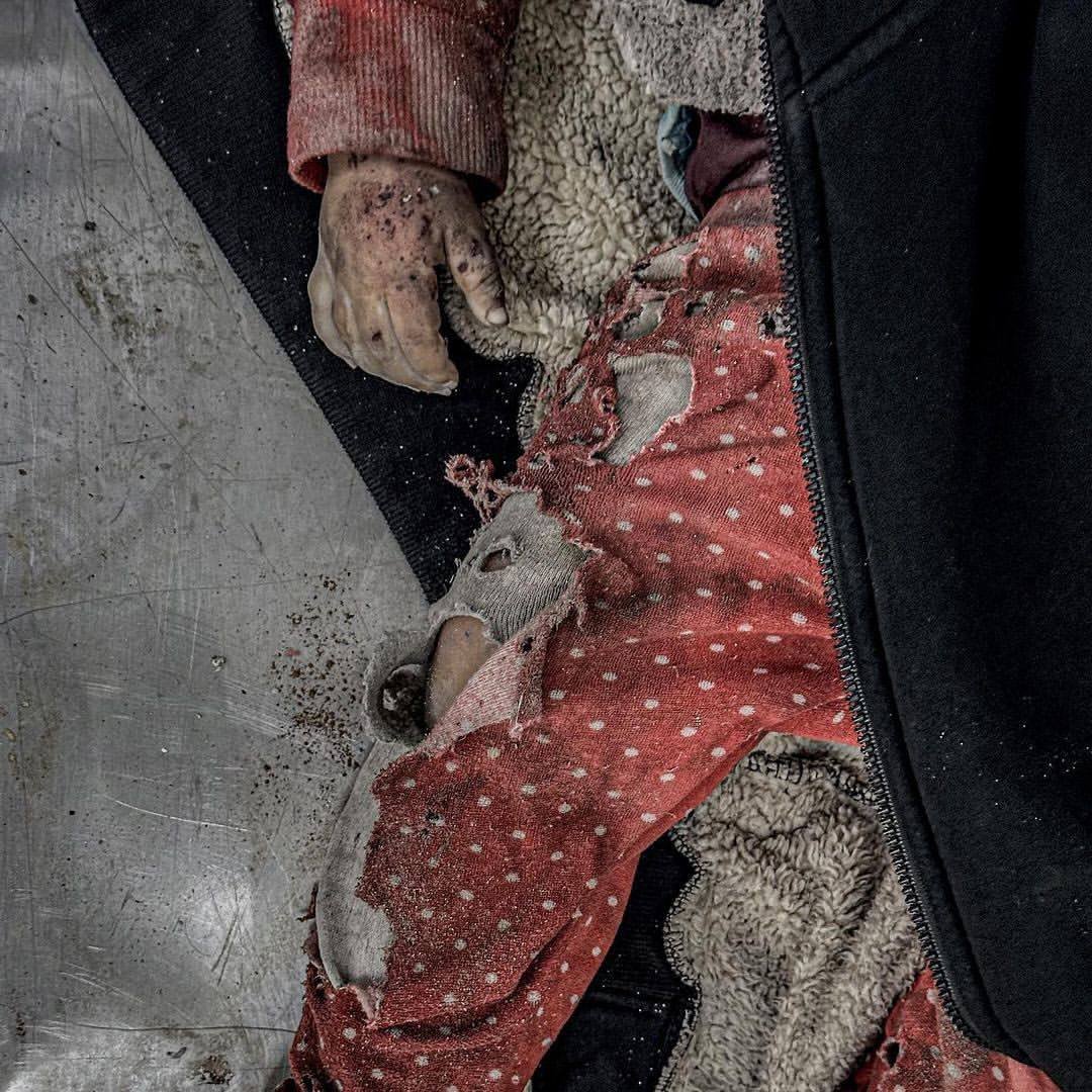 Don't Look Away | Multiple children, including infants, were injured in the Israeli airstrikes on Deir Al-Balah earlier today.