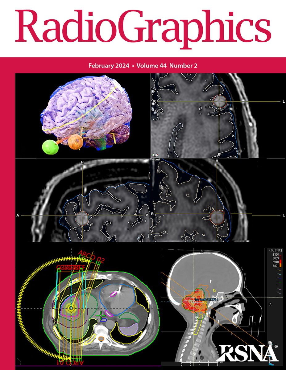 The latest issue of RadioGraphics is now available! Check out the February issue here. bit.ly/NewRadG #RGphx #RadCME #RadRes @RadG_Editor