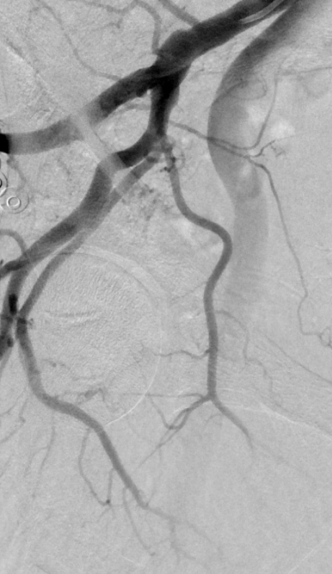 Aaron Fischman MD | Interventional Radiologist tweet media