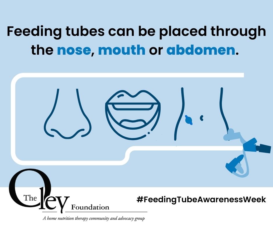 ASPEN_nutrition's tweet photo. This week is #FeedingTubeAwarenessWeek! Tube feeding can improve quality of life by easing symptoms such as #malnutrition, dehydration, and discomfort with eating. Check out the ASPEN #EN resource center (https://t.co/HucnWEREnO) and visit @OleyFoundation for more info on #FTAW! https://t.co/qHahUbYHpX
