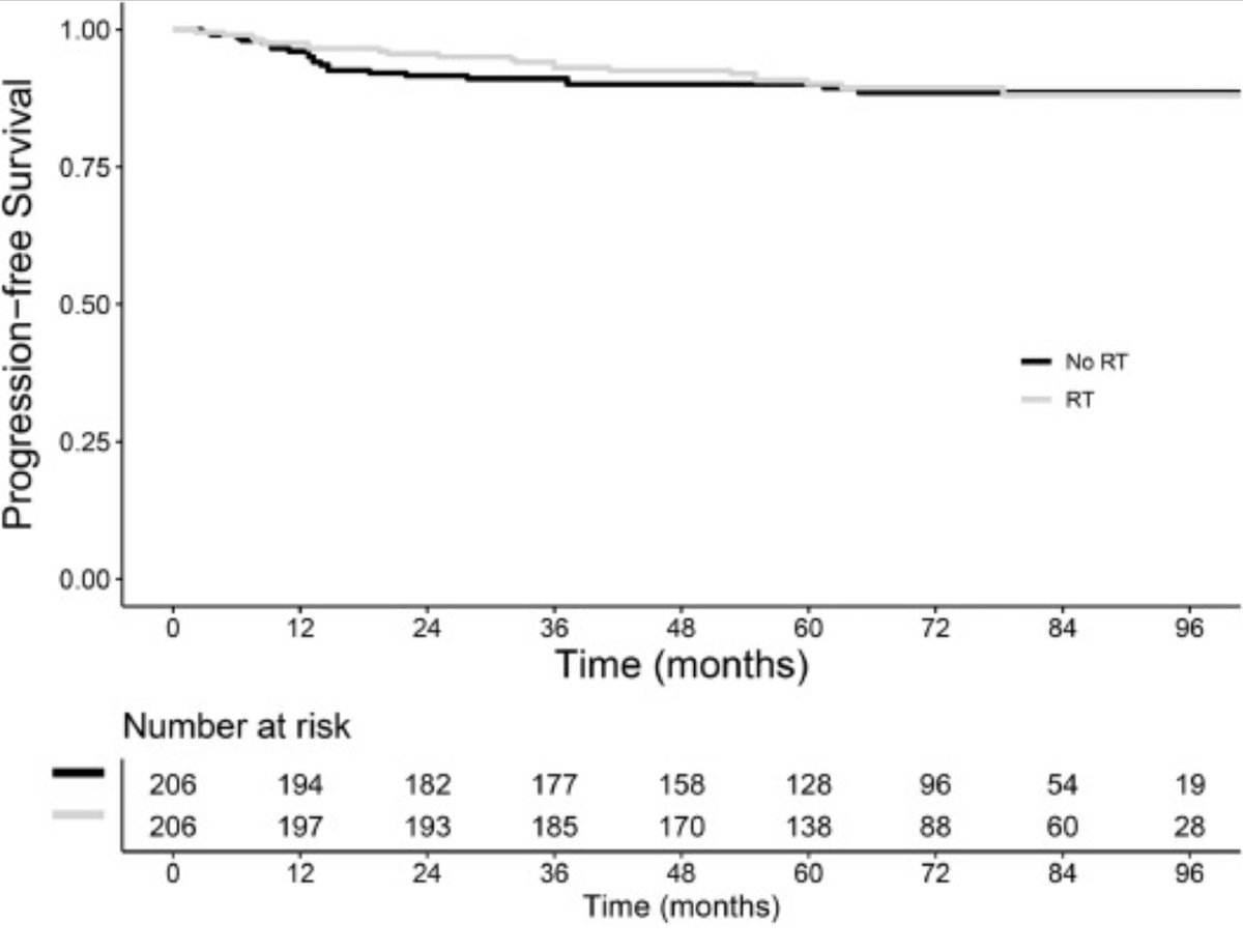 In a combined analysis of reconstructed data from two modern trials +\- consolidative RT ☢️ for pts with advanced Hodgkin lymphoma #lymsm with initial bulk after CR to ABVD, we found no PFS benefit to ☢️ 

A #NorthCarolina #Tennessee #radonc collab!

doi.org/10.1016/j.adro…