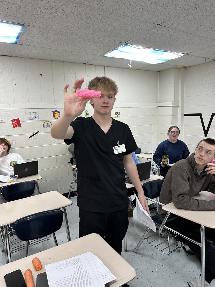 tenillerauls's tweet image. Sweetheart week Barbie and Ken day yesterday. We also deciphered types of common fractures and then splinted them with casting material. Fun day of learning. #orthofun #fractures #splinting