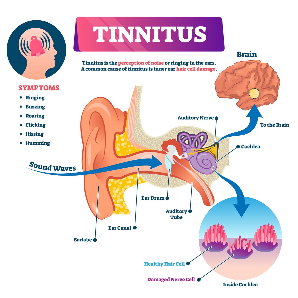 Tinnitus Awareness Week, 5-11 February 2024 helps spread awareness, information & support to those who live with tinnitus
Tinnitus is the perception of noise or ringing in the ear of which 15-20% of people experience. #TinnitusWeek #tinnitus