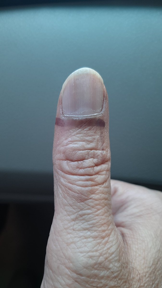 MHaiderBaig's tweet photo. Alhumduillah I voted for NA 248 PS 125
@ImranKhanPTI
@PTIofficial @MoeedNj @ARYSabirShakir @ImranRiazKhan #ImranKhanPTI
#Elections2024 #ووٹ_ڈالو_خان_نکالو
   #عمران_خان_تو_آئے_گا #PakistanElection https://t.co/Bo6n0MOA6a