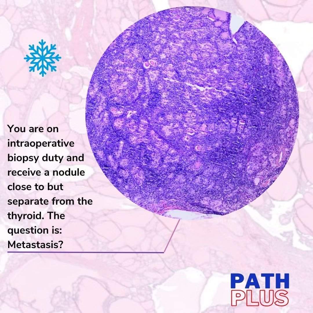 GeronimoJrLapac's tweet photo. ✅How about starting your Thursday with a super TIP and PITFALL ALERT?
🎯All this and much more you can check out at https://t.co/ECNcOJ2aLr
#pathplus #pathology #entpath https://t.co/wbi6S9BaOp