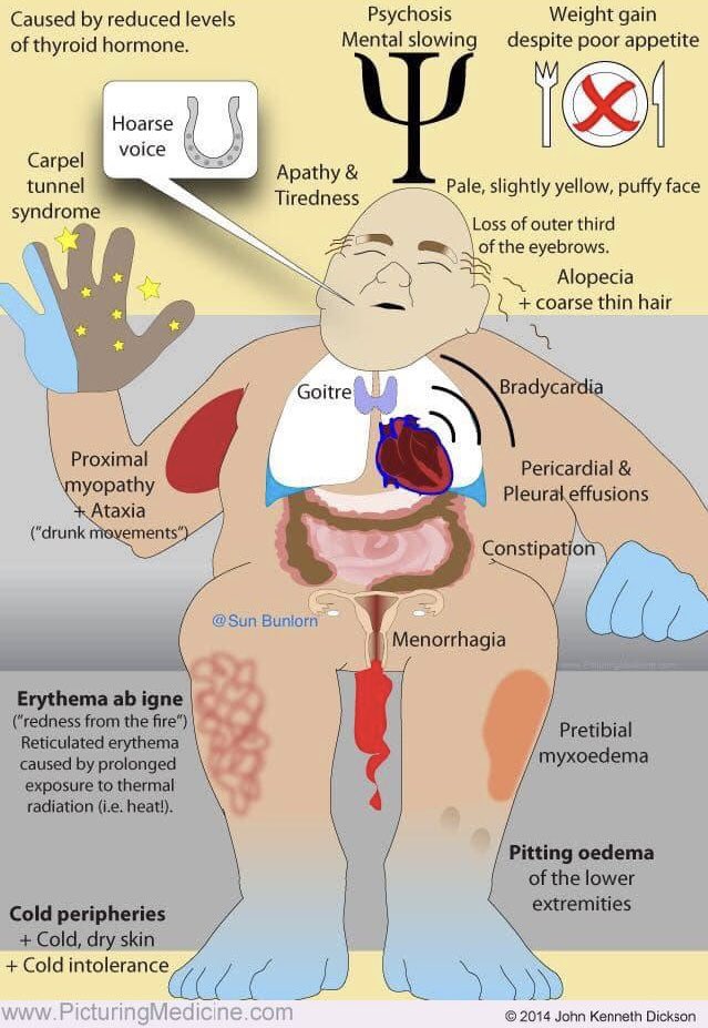 Diagnosis? (Picturing Medicine) #medX