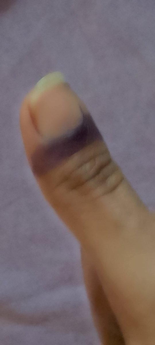 Voted🔴🟢 میں نے پاکستان کو ووٹ دیا۔ #VoteForImranKhan #Election2024pakistan #ImranKhanFightingForPakistan #ووٹ_ڈالو_خان_نکالو #ظلم_کابدلہ_ووٹ_سے #ظلم_کا_جواب_ووٹ_سے #ظلم_کا_حساب_ووٹ_سے @iqra953 @iqra1491