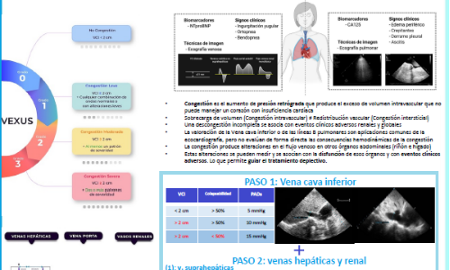 💥💛 VExUS, valoración ecográfica de la congestión

🧑‍⚕️ Alejandro Lara García

Descarga la infografía ➡️  cardioteca.com/infografias-ca…