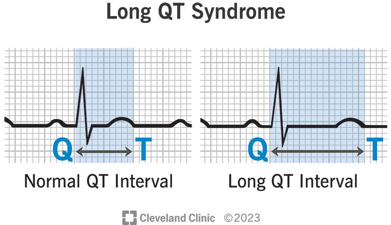 PharmaMed✨💊

📊 Which medication is known to lengthen the QT interval?

A. Amiodarone
B. Bisoprolol
C. Ibuprofen
D. Omeprazole

#MedicationSafety #QTInterval'