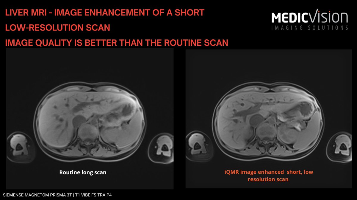 Medic Vision Imaging Solutions tweet media