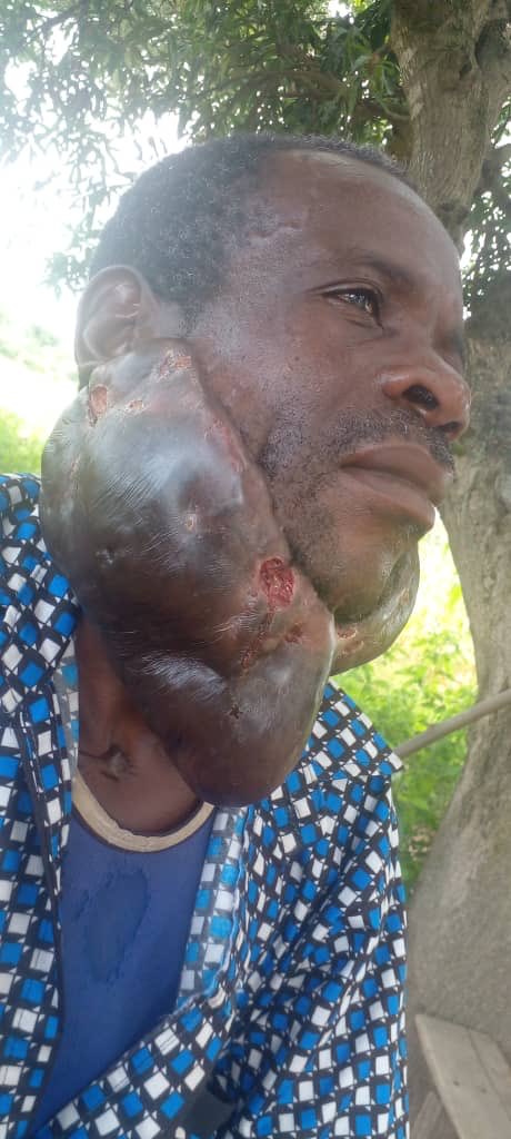 RETWEET 🙏🏾

Kabla haujafa haujaumbika Msaada hapa Kuwafikia Viongozi wa juu Ili apate msaada

Na Oscar Msuya 0713059065

Munda Elias (46) Mkazi wa kijiji cha Mwanekeyi, kata ya Mantare wilaya ya Kwimba mkoa wa Mwanza

<a href="/ummymwalimu/">Ummy Mwalimu</a> <a href="/MwanaFA/">Falsafa Baba!</a> <a href="/moodewji/">Mohammed Dewji MO</a> <a href="/mwigulunchemba1/">Mwigulu Nchemba, PhD</a> <a href="/SuluhuSamia/">Samia Suluhu</a>