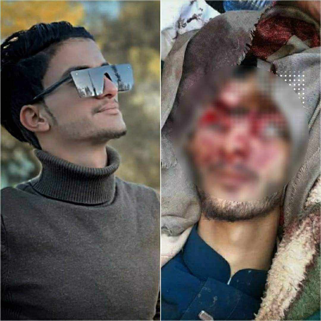 مطلوب من حكومة صنعاء تنفيذ العدالة بالقتله الذين قاموا بقتل هذا الشاب 
وبالاعدام كما حصل لقتله الشاب عبدالله الاغبري 
ونتمنى عدم المتاجرة بدماء اليمنيين من قبل رواد الفنادق  الذين يتصيدون لكل قضية لصالح كفيلهم