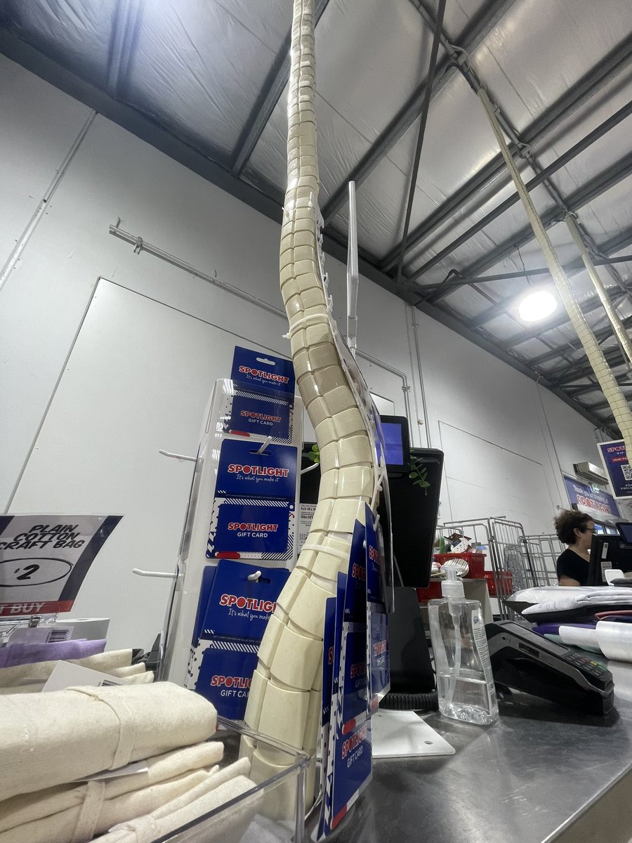 spotlight scoliosis