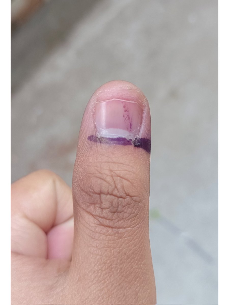 ShykhTalha2's tweet photo. اپنا قومی فریضہ ادا کردیا  ❤️

#ووٹ_ڈالو_خان_نکالو #GeneralElectionN0W #PakistanElection #PakistanElection2024 #NA155 # https://t.co/CuZPJeSoVT