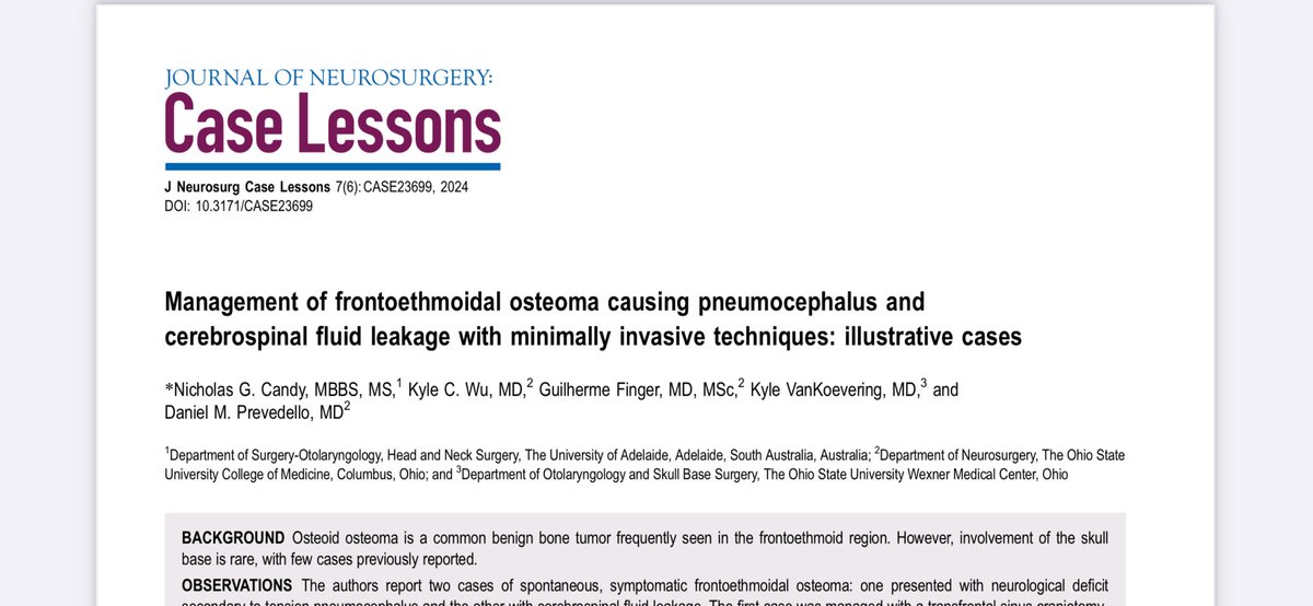 DrNickCandy's tweet image. Illustrative cases from the OSU Skull Base Team on minimally invasive techniques used to manage frontoethmoidal osteomas with pneumocephalus. @PrevedelloDanny @guilherme_fngr @KyleWuMD
thejns.org/caselessons/do…