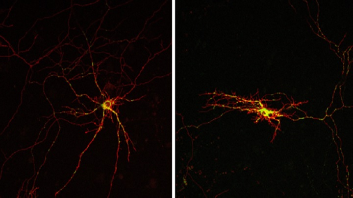 Universitat de Barcelona (@unibarcelona) on Twitter photo #RecercaUB | 🧠Un estudi codirigit per Eduardo Soriano, de l’<a href="/UBneuroscience/">Institut de Neurociències de la UB</a>, revela un mecanisme decisiu relacionat amb la mort neuronal i les alteracions motores en mamífers evolucionats.
👉 web.ub.edu/web/actualitat… #RecercaUB | 🧠Un estudi codirigit per Eduardo Soriano, de l’<a href="/UBneuroscience/">Institut de Neurociències de la UB</a>, revela un mecanisme decisiu relacionat amb la mort neuronal i les alteracions motores en mamífers evolucionats.
👉 web.ub.edu/web/actualitat…