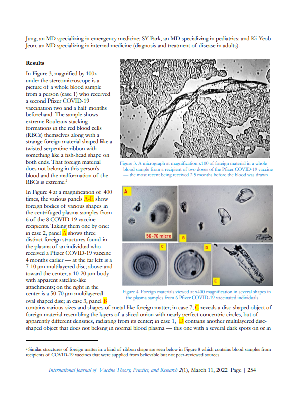 mRNAdeaths's tweet photo. Foreign Materials in Blood Samples of Recipients of COVID-19 Vaccines
https://t.co/RA73gNlIbr https://t.co/MeZ4Epebde