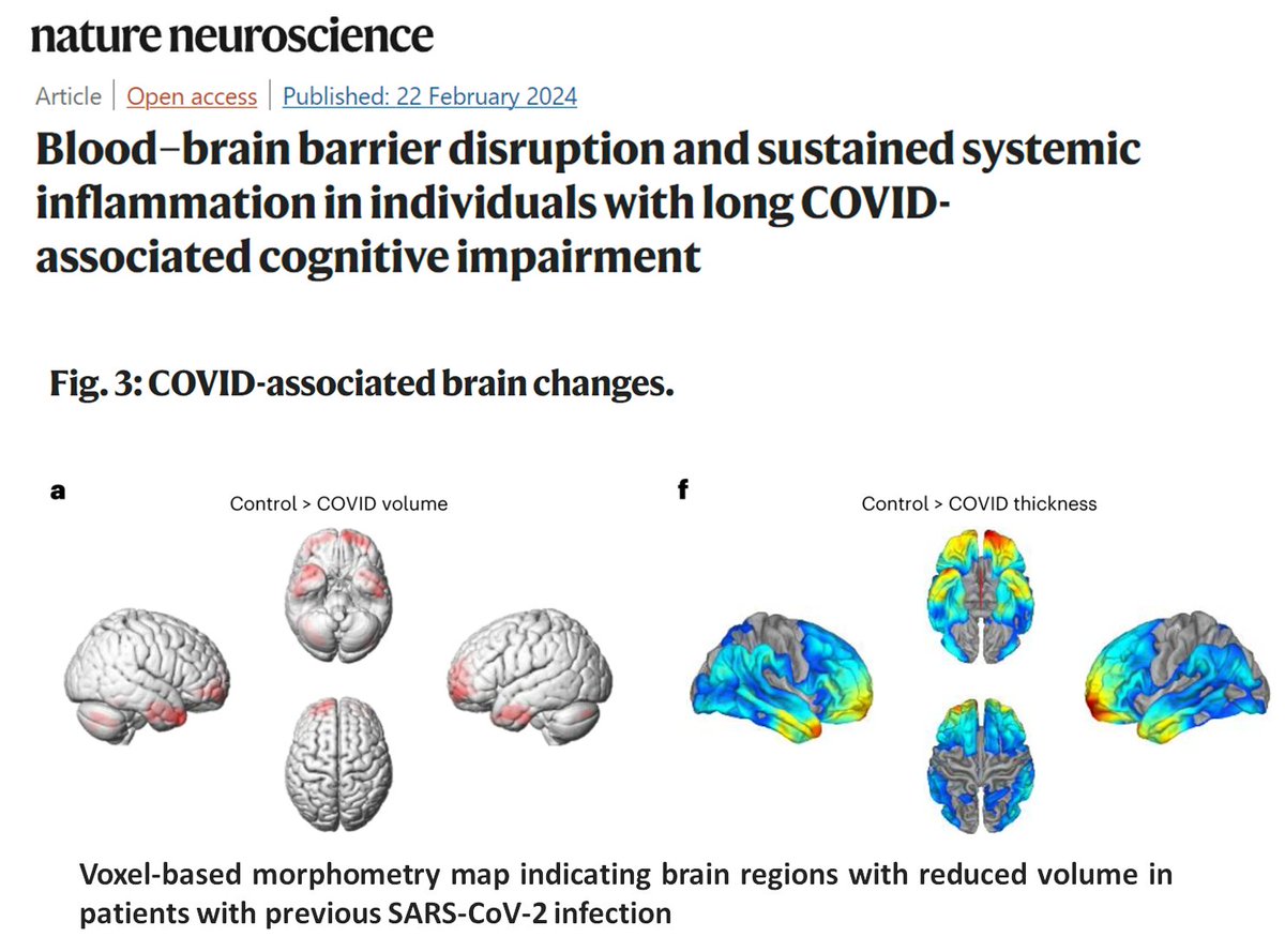 Leaky blood-brain barrier in long-COVID associated brain fog This study confirms everything I have seen in the microscope over the last few years. They use a technique called dynamic contrast-enhanced magnetic resonance imaging (DCE-MRI), an imaging technique that can measure