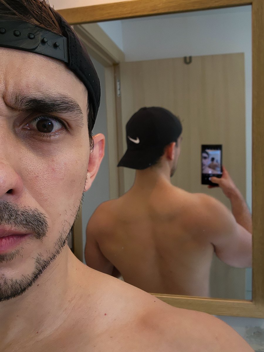 Back is bulking, eyes are racooning 🦝