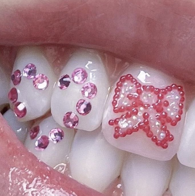 heartipink's tweet photo. thinking of tooth gems https://t.co/Qp9v0QjtOe