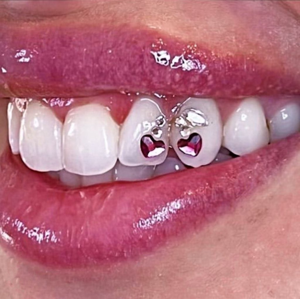 heartipink's tweet photo. thinking of tooth gems https://t.co/Qp9v0QjtOe