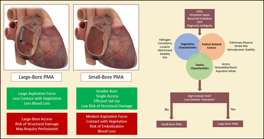 📚Curious about pt selection, device choice, & procedural planning for percutaneous mechanical aspiration in infective endocarditis? 🔎Read this review outlining a systematic approach, & tips & tricks for performing these interventions. ➡️ doi.org/10.1016/j.jsca…