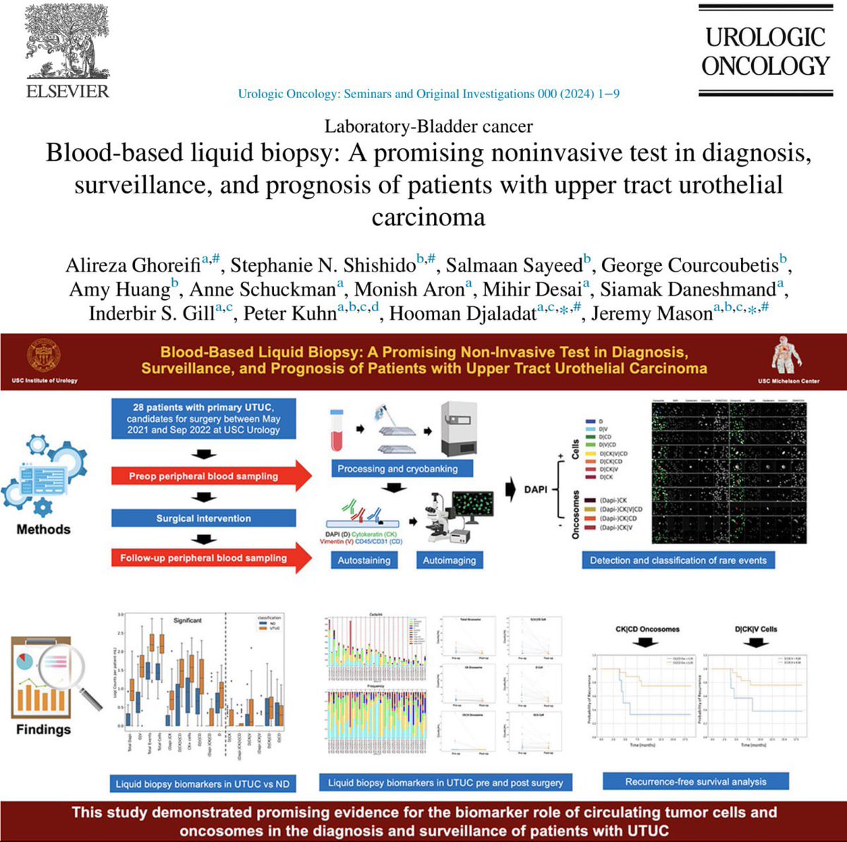 🔥Happy to share our recent @UrolOncol paper 1️⃣Dx: CTCts and oncosomes are detectable in UTUC PBSs at higher levels than normals 2️⃣FU: 6 analytes exhibit sig decrease after surgery 3️⃣Prognosis: CK|CD oncosomes and D|CK|V cells can predict recurrence 🔗tinyurl.com/3jr5wrx2