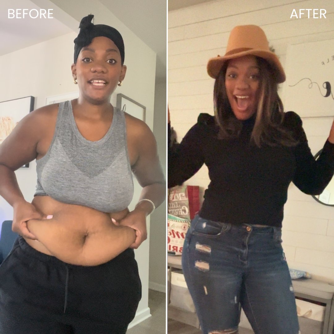 SonoBello's tweet image. &quot;You can&apos;t tell me nothinnnnn. I feel hot. I feel sexy,&quot; she says. Ok, Bethenny! We see you! 👏

📝Procedure: AbEX
🧐 Areas: Full Abdomen and Waist
➡️ Free Consultation: bit.ly/40QA51Y
#SonoBelloAmbassador #LifeChangingResults #SameDayProcedure